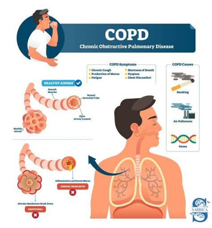 What professionals are involved with COPD?